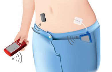 Breakthrough for artificial pancreas