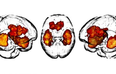 Researchers publish glioma frequency map