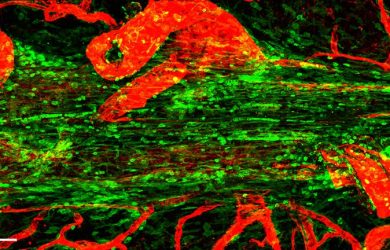 Gut bacteria links to immune responses in the brain