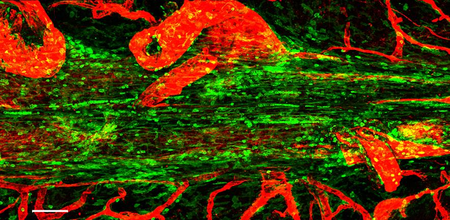 Gut bacteria links to immune responses in the brain